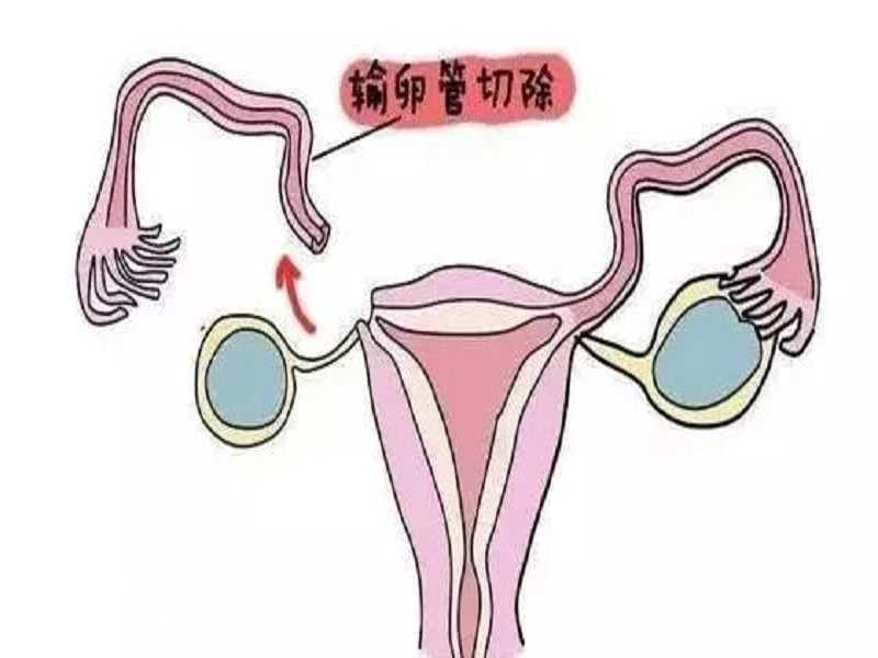 北京哪个医院可做供卵试管婴儿（私人医院供卵试管）