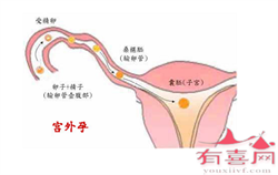 北京代生哪做的最好，胚胎影响试管成功率吗、哪种移植方法利于胚胎着床？