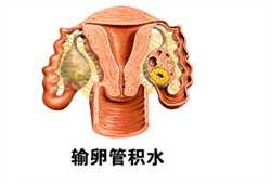 北京助孕产子的包男孩~北京医院供卵~，孕妇有痔疮出血怎么办