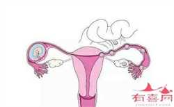 染色体异常可以做三代试管吗，子宫发育不全是什么原因？