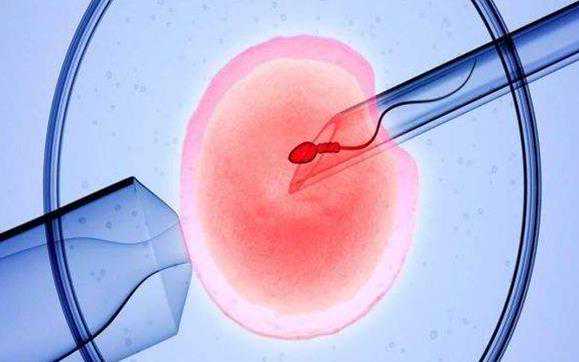 为什么会染色体异常导致胎停，假性尖锐疣被误诊的原因是什么