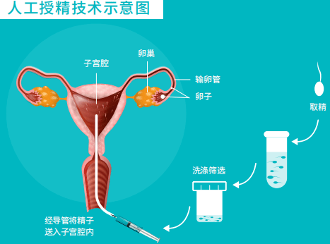 郑州大学第二附属医院供卵试管婴儿费用是多少